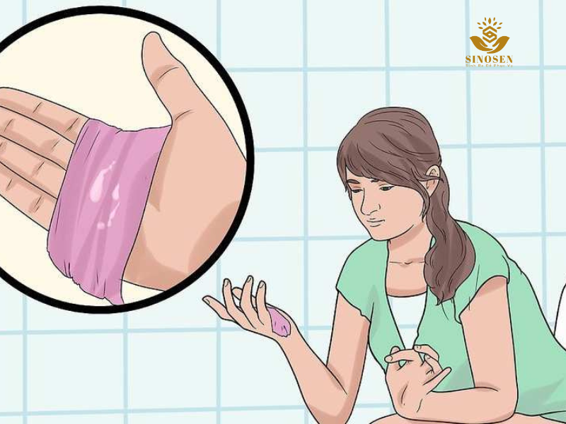nguyên nhân có mùi vùng kín