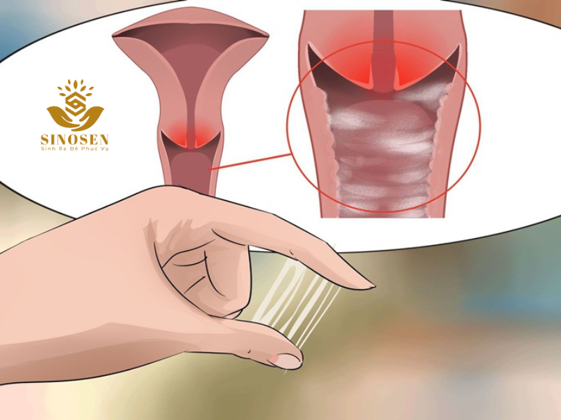 Những lưu ý khi vệ sinh vùng kín