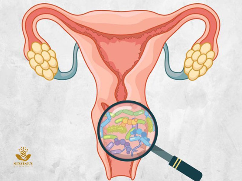 Lưu ý khi dùng dung dịch vệ sinh có tính kiềm