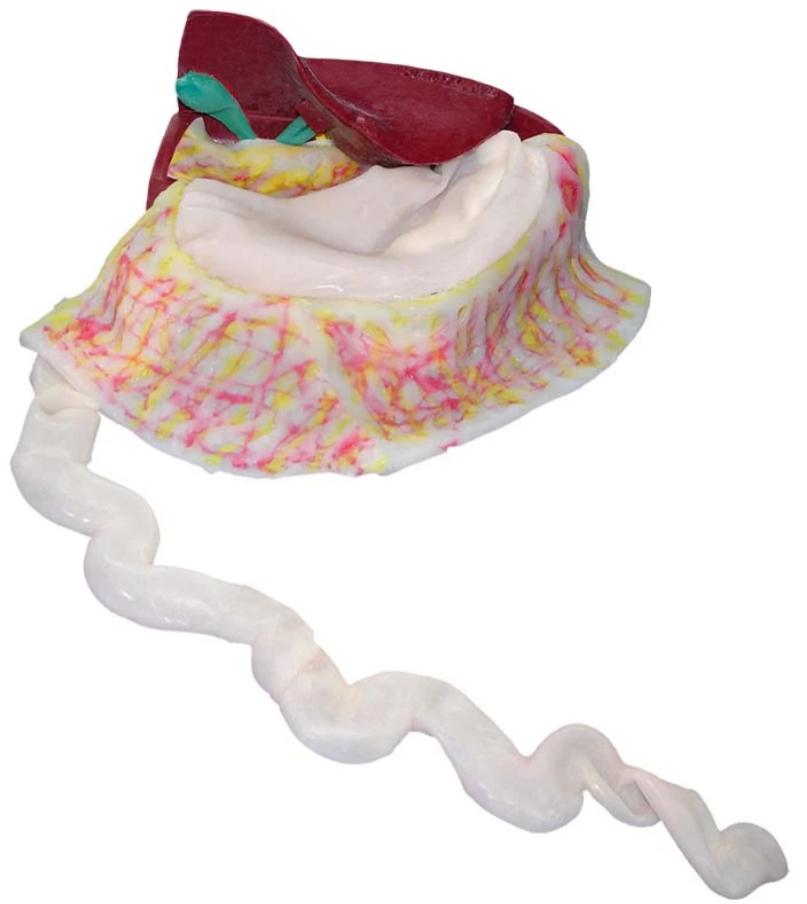 mô hình phẫu thuật cắt túi mật nội soi