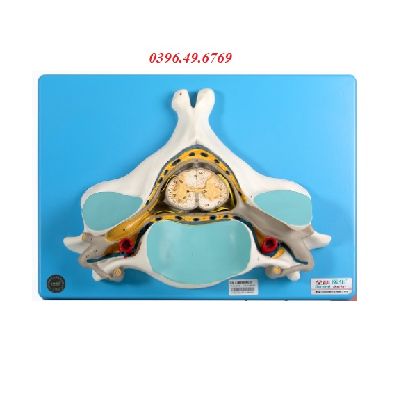 MÔ HÌNH CẮT NGANG TUỶ SỐNG MODEL GD/A18104