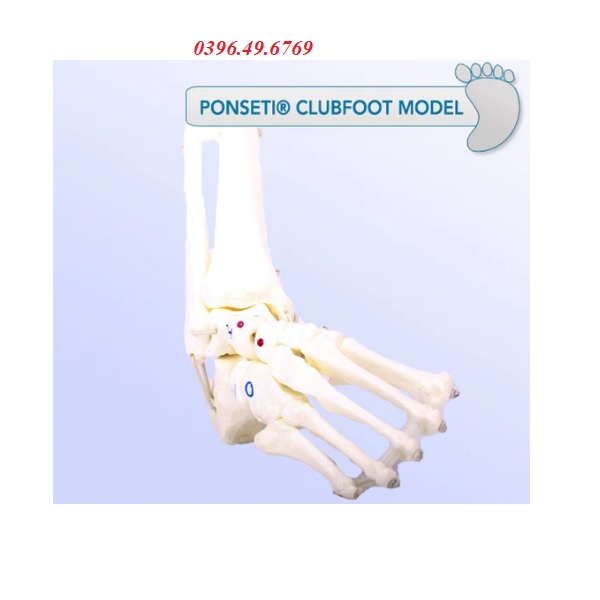 MÔ HÌNH XƯƠNG BÀN CHÂN KHOÈO