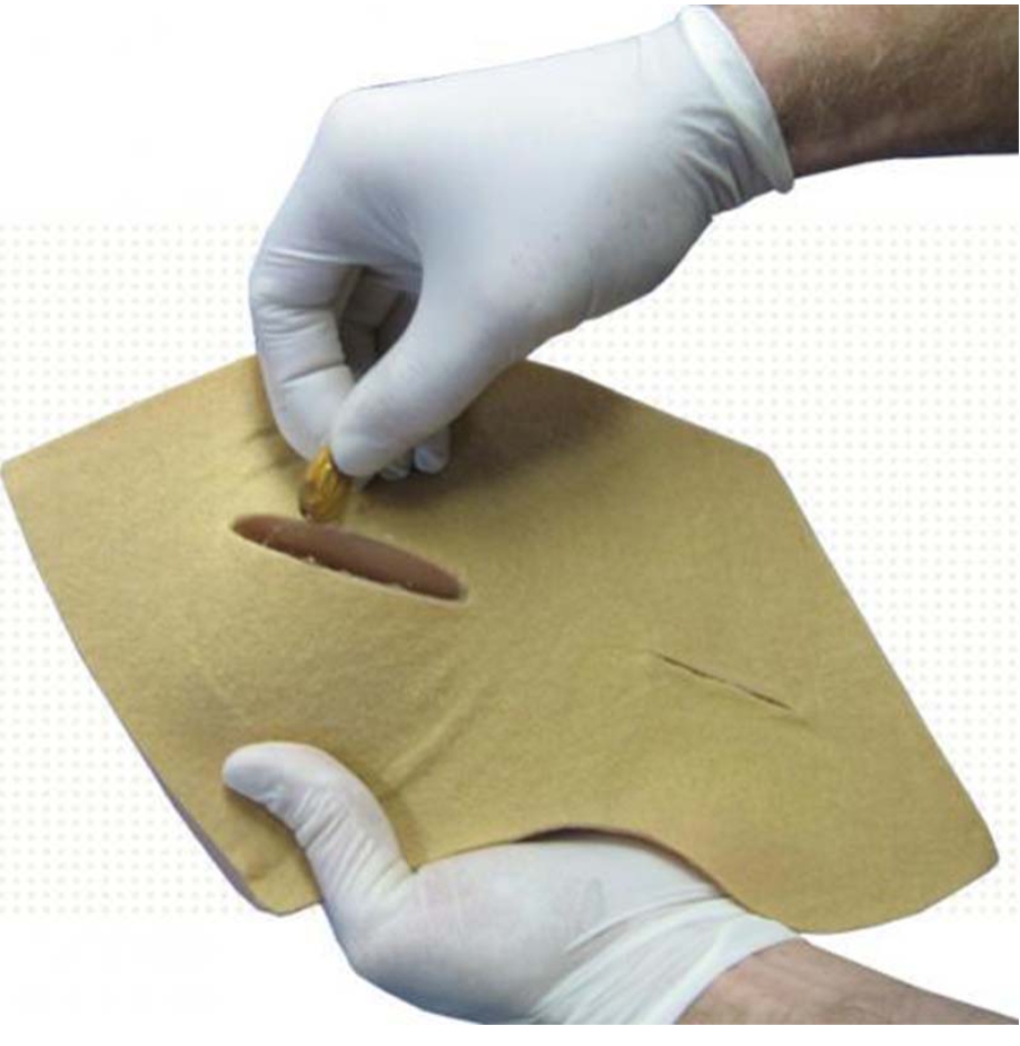 Mô hình đào tạo thăm dò tuyến vú