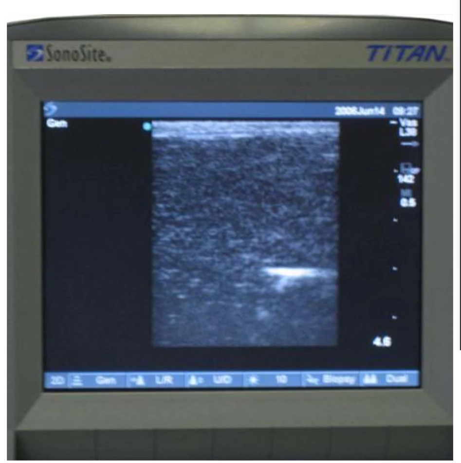 Mô hình đào tạo thăm dò tuyến vú