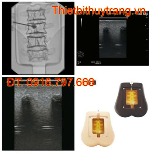 Mô Hình Chọc Dò Thắt Lưng Siêu Âm Kyoto Kagaku Nhật Bản