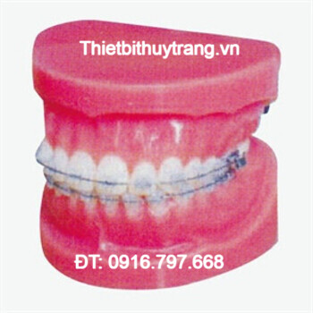 MÔ HÌNH GIẢI PHẪU CHỈNH NHA CỐ ĐỊNH GD/B10036