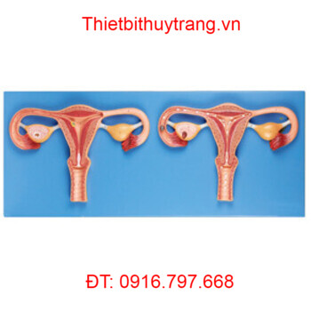 MÔ HÌNH TỬ CUNG VÀ BUỒNG TRỨNG GD/A42001