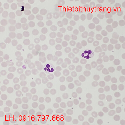 TIÊU BẢN BỆNH HỌC HUYẾT HỌC Ở NGƯỜI