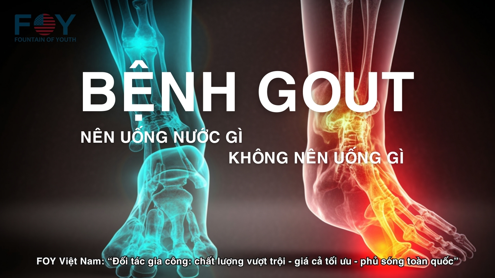 Bệnh Gout Nên Uống Nước Gì Và Không Nên Uống Gì?