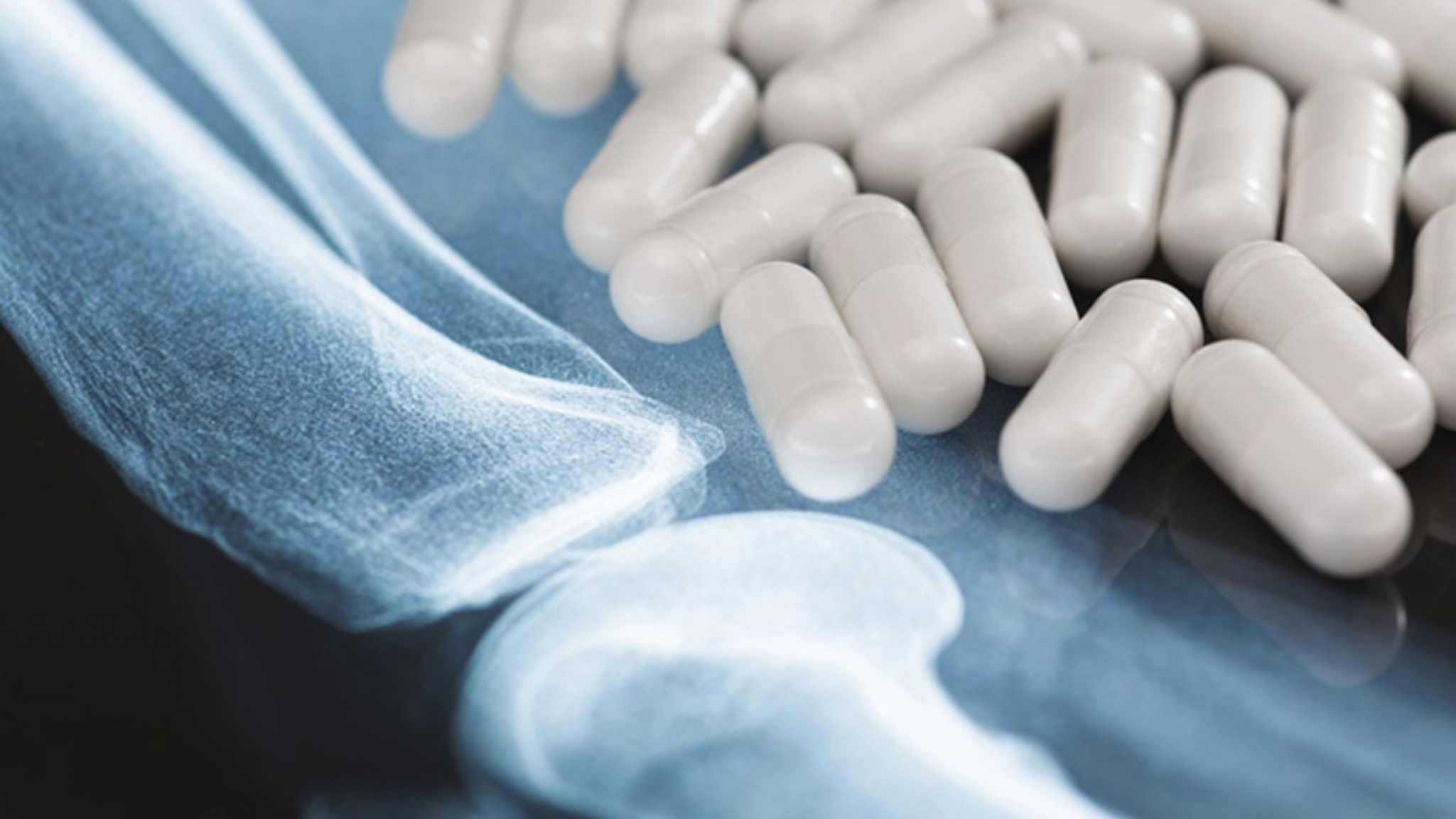 Liều dùng của Glucosamine