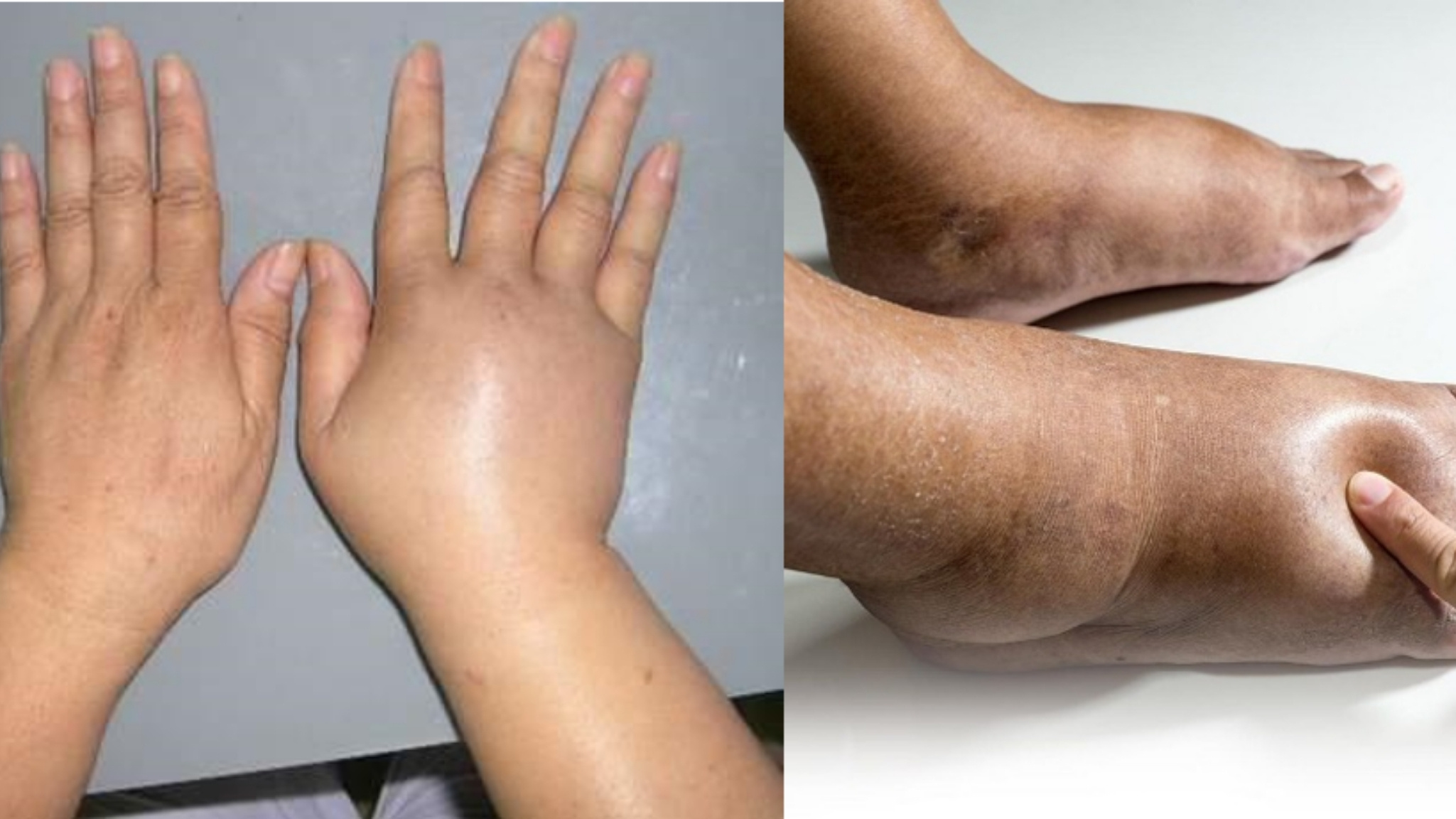 Một số dấu hiệu nên tạm ngưng uống thực phẩm chức năng