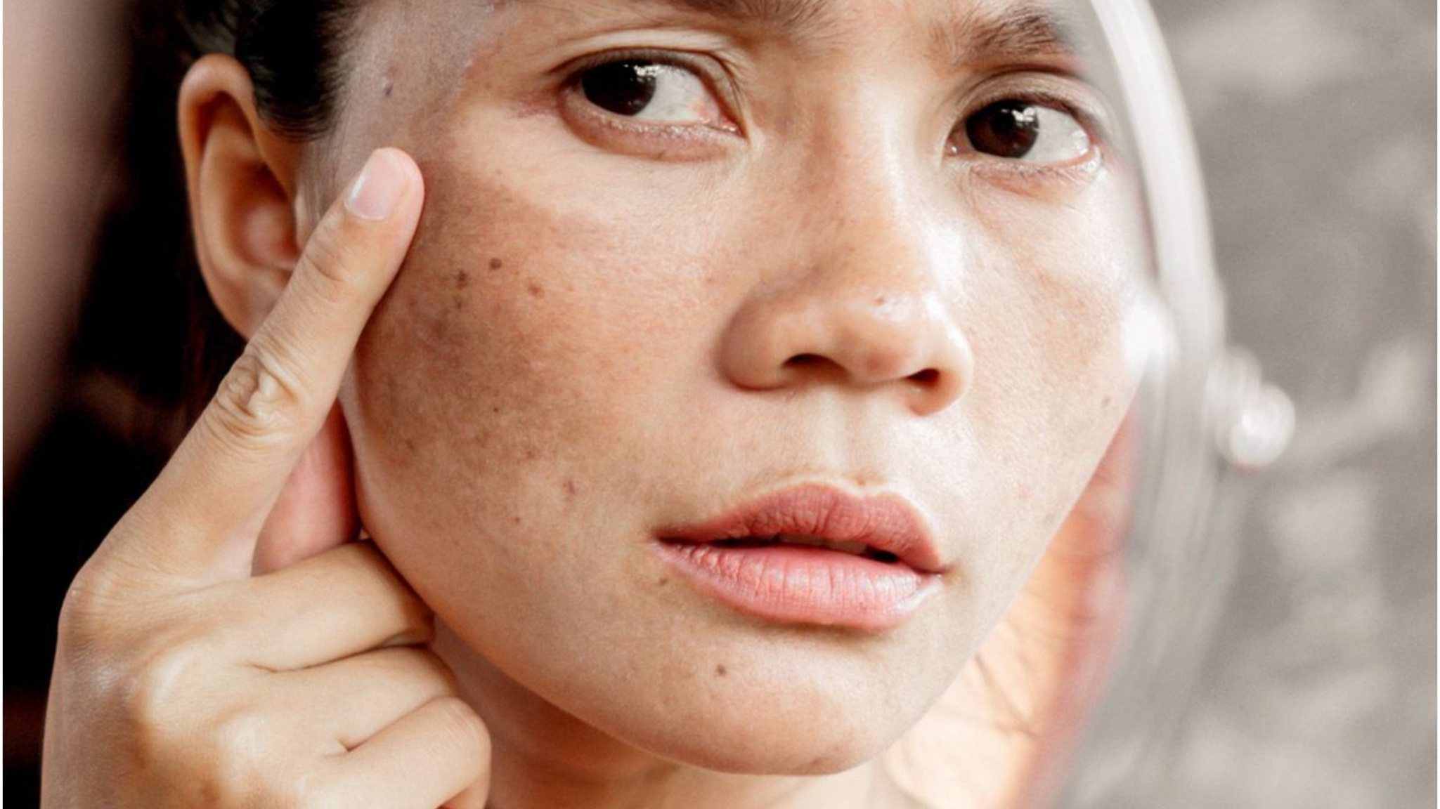 NMN có thật sự chống lão hóa không?