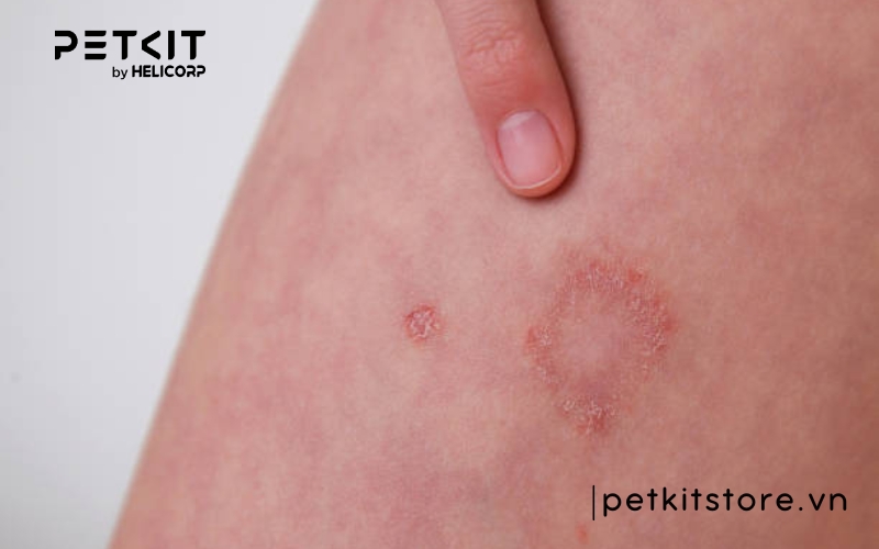 Mèo bị nấm có lây sang người không, dấu hiệu nấm mèo ở người