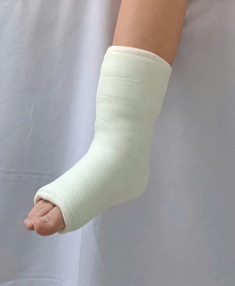 bó bột sợi thủy tinh trẻ em