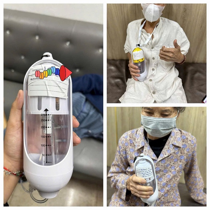 SỬ DỤNG BƠM TRUYỀN GIẢM ĐAU PCA