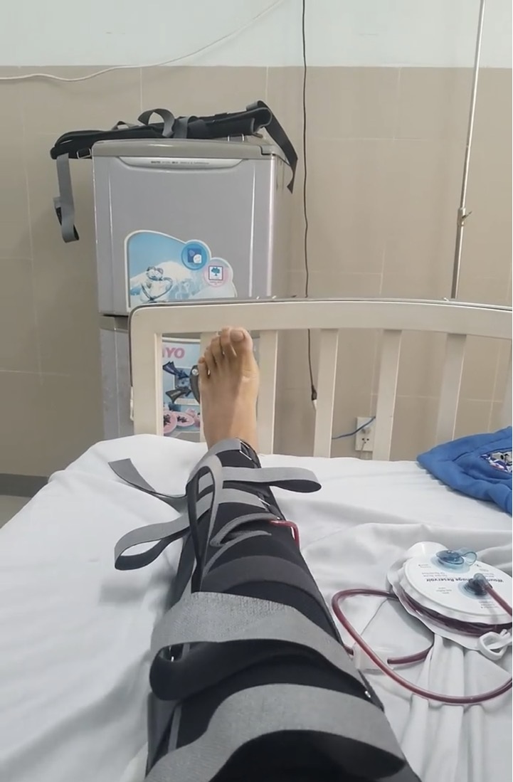 sử dụng quả dẫn lưu áp lực âm kín