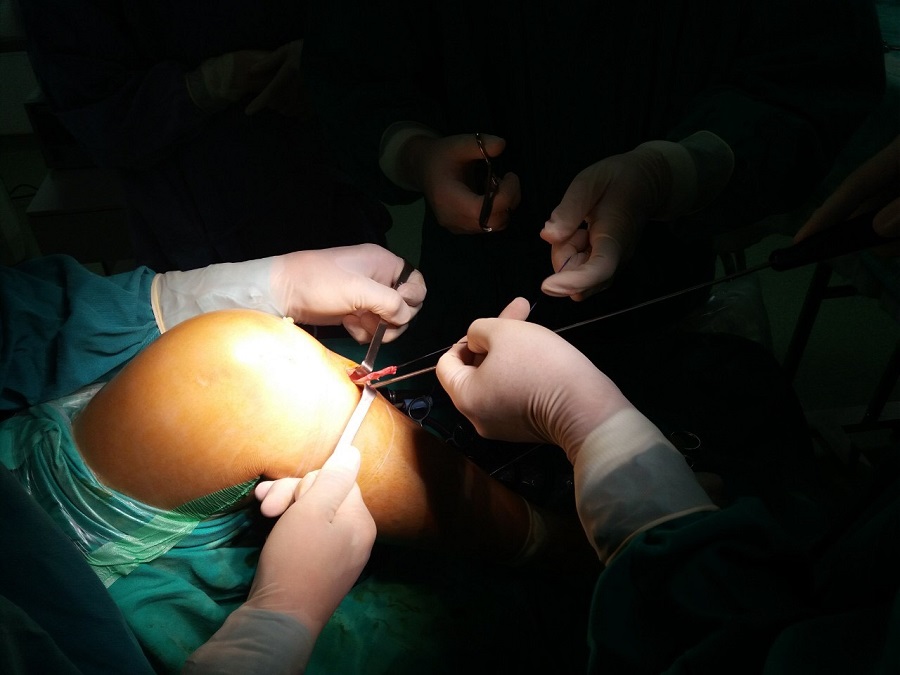 miếng dán phẫu thuật opsite