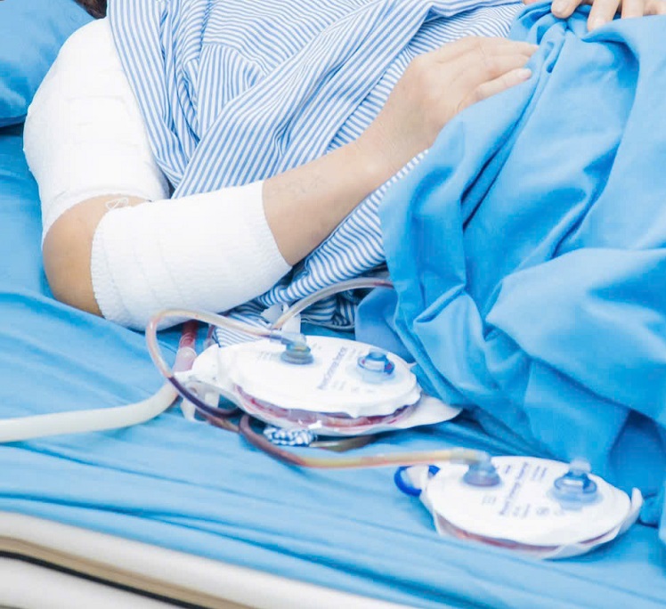 Bình Dẫn Lưu Áp Lực Âm