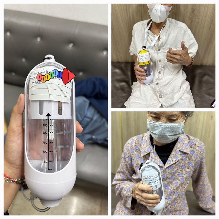 sử dụng bộ truyền giảm đau PCA