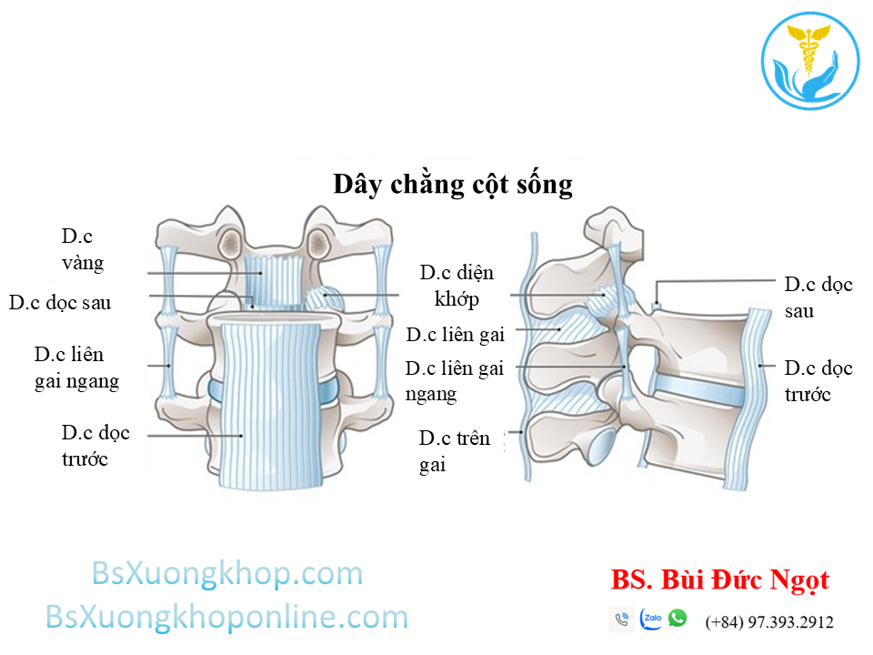 Tổn thương dây chằng cột sống ||| BsXuongkhop.com