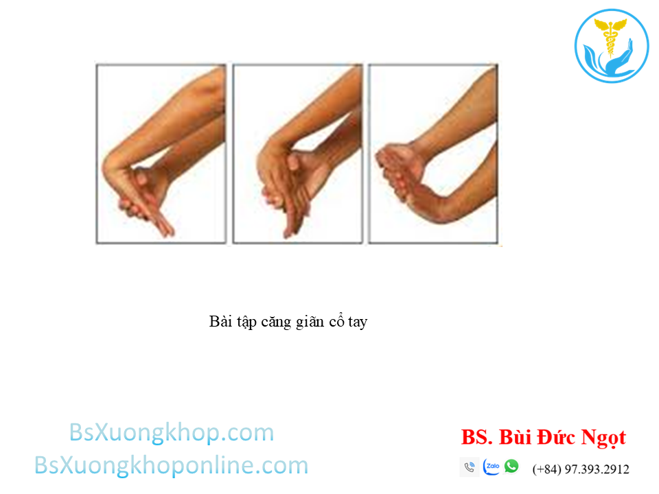 Bài tập cải thiện tennis elbow | BsXuongkhop.com