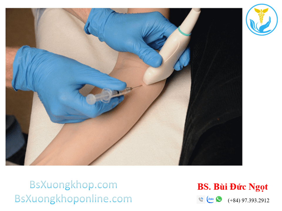 Bệnh lý tennis Elbow | BsXuongkhop.com