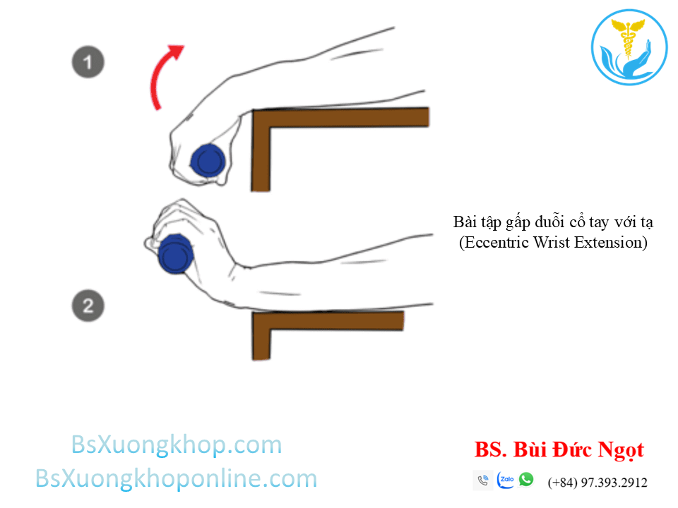 Bài tập cải thiện tennis elbow | BsXuongkhop.com