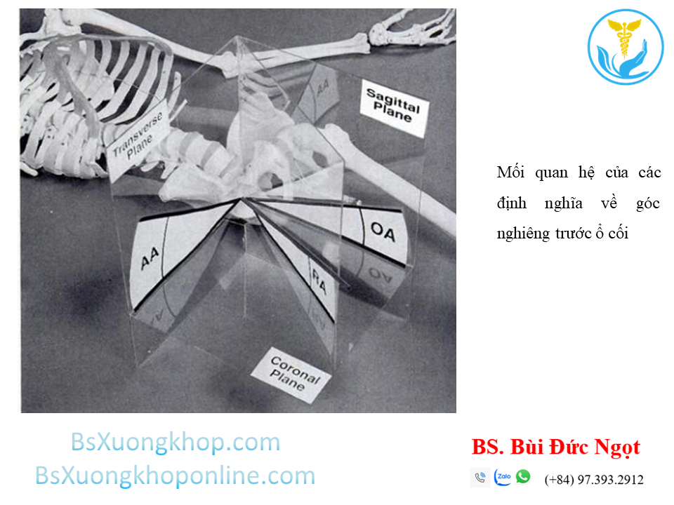 Mối quan hệ giữa các định nghĩa về góc nghiêng trước ổ cối
