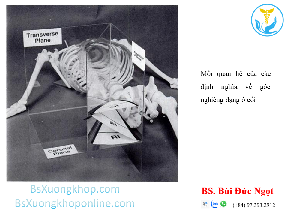 Mối quan hệ giữa các định nghĩa về góc nghiêng dạng ổ cối