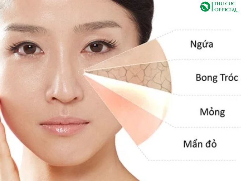 da nhạy cảm là gì