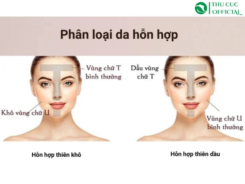 Đặc điểm của da hỗn hợp