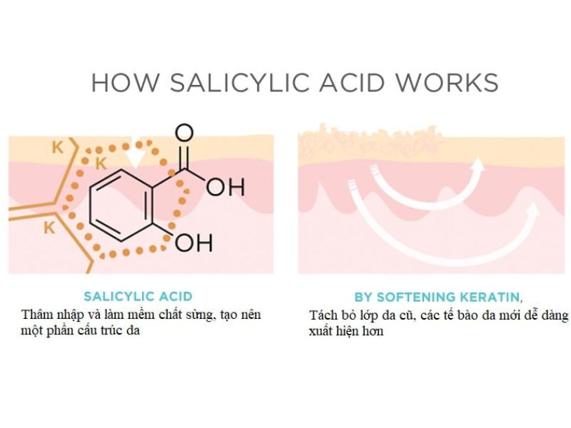Axit salicylic hoạt động thế nào