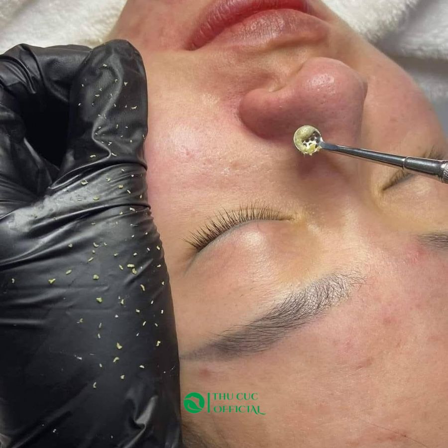 Hướng dãn sử dụng bột ủ mụn Anna Lotan