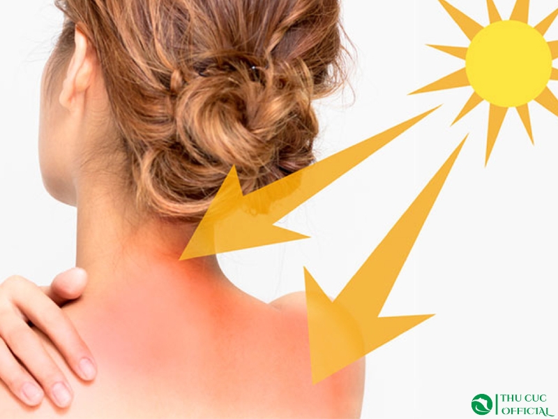 Tác động trực tiếp của ánh nắng với làn da