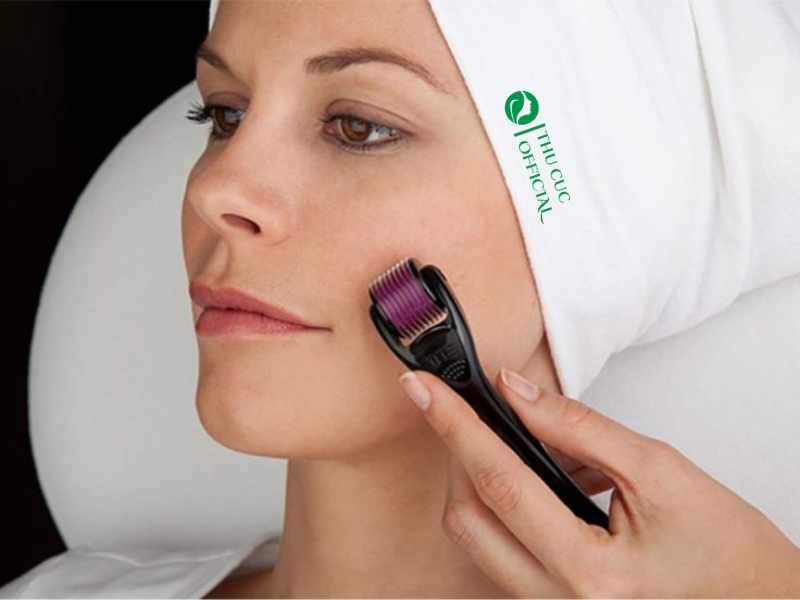 Chăm sóc da sau lăn kim đúng cách