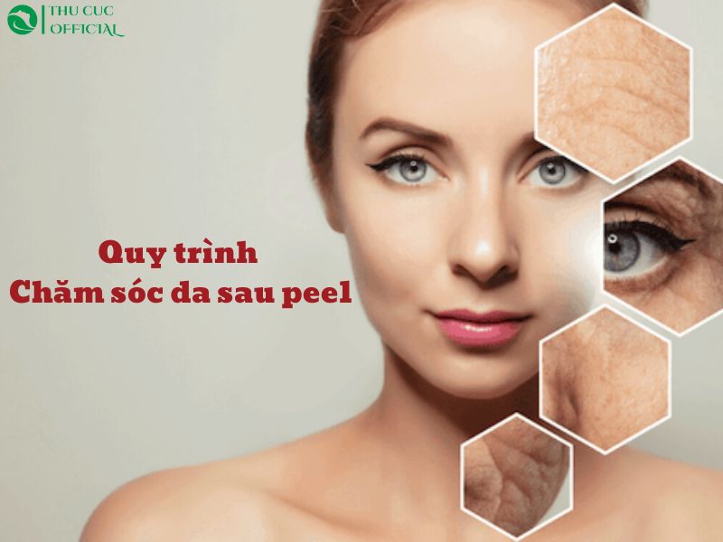 Quy trình chăm sóc da sau peel