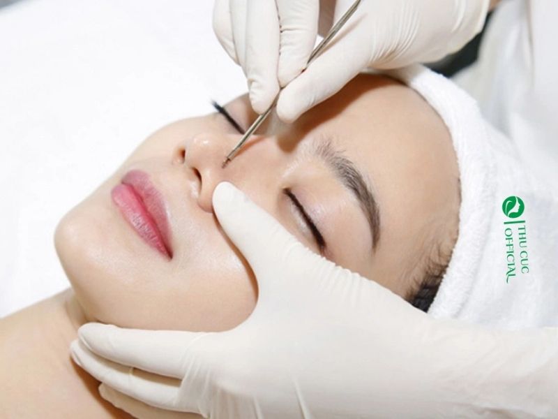 Dịch vụ nặn mụn chuẩn y khoa