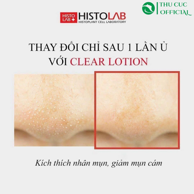 Histolab Histo Clear Lotion 1200ml