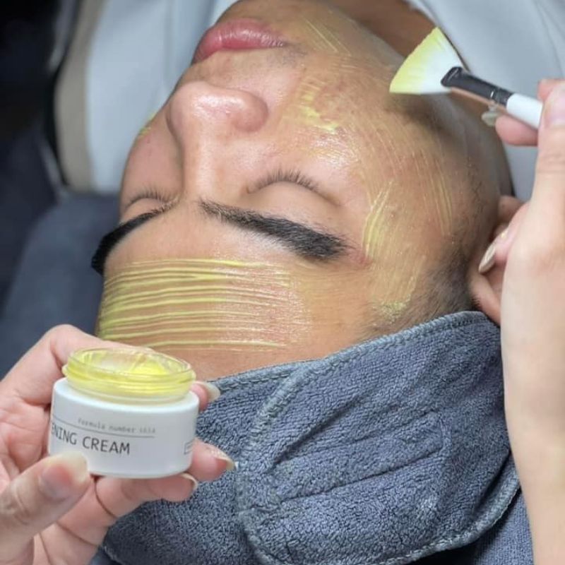 Hướng dẫn sử dụng Peel chữ A Innoaesthetics