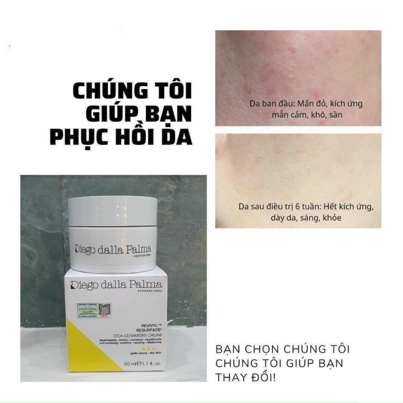 Hướng dẫn dùng kem phục hồi Diego