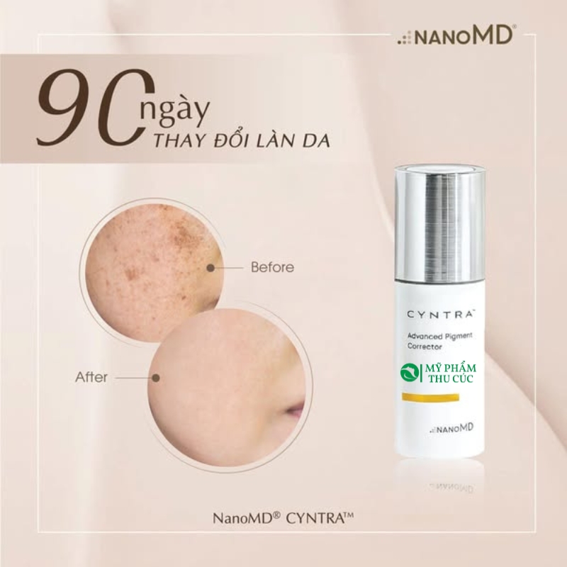 Kết quả sau khi dùng kem nám Cyntra NanoMD