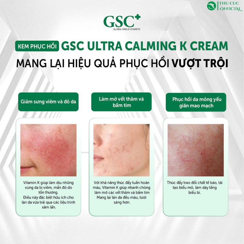 Kem dưỡng GSC Ultra Calming K Cream dành cho loại da nào