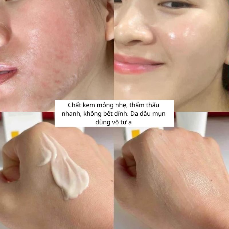 Hiệu quả sử dụng kem dưỡng Innoaesthetics Skin Repair
