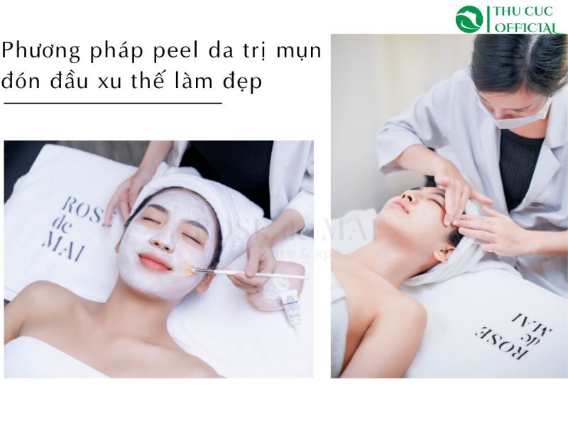 Phương pháp peel da giảm mụn