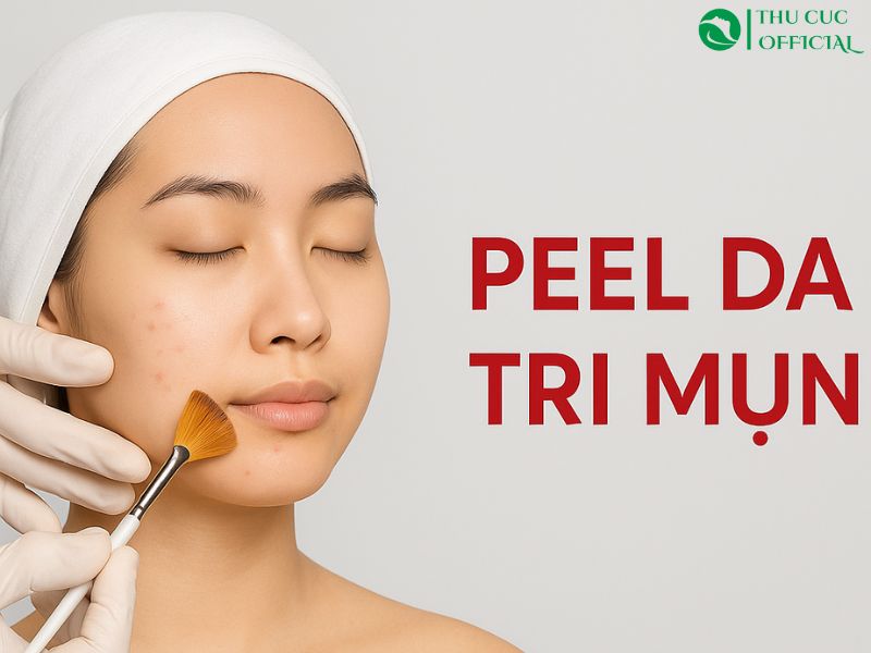 Quy trình peel da trị mụn
