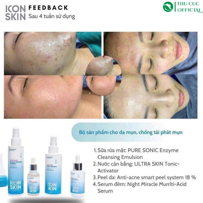 Đánh giá hiệu quả dùng peel giảm mụn ICON SKIN