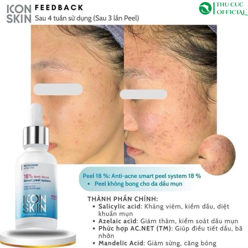 Hướng dẫn sử dụng Peel mụn Icon Skin