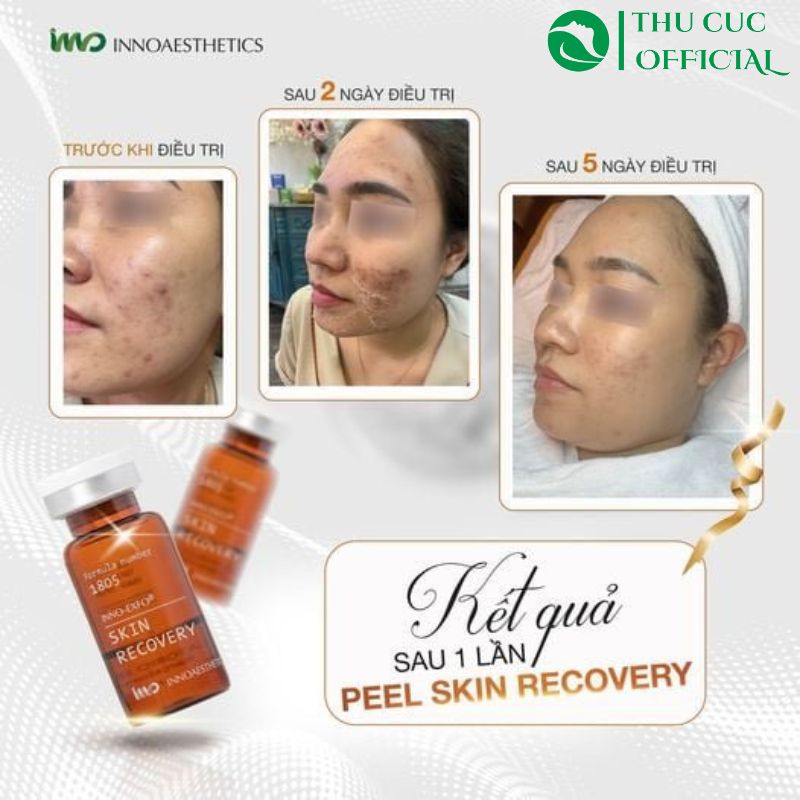 Đánh giá hiệu quả sử dụng Skin Recovery Innoaesthetics