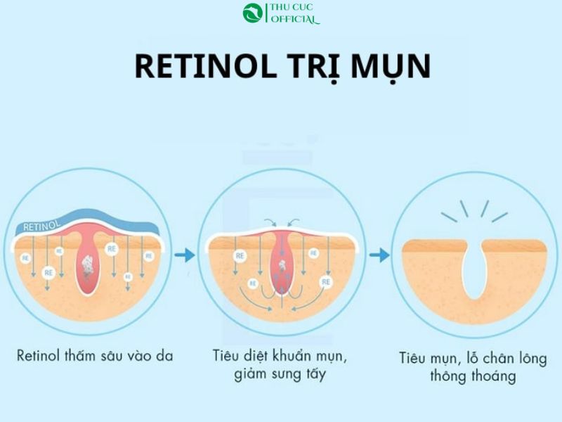 Ứng dụng retinol trị mụn