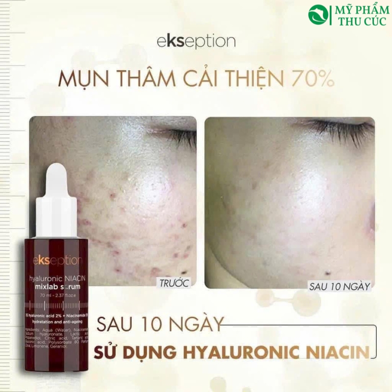 Hiệu quả sử dụng Serum Niacin Ekseption